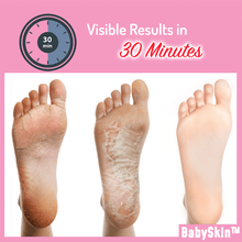 Load image into Gallery viewer, BabySkin Ultimate Foot Peeling Mask