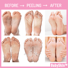 Load image into Gallery viewer, BabySkin Ultimate Foot Peeling Mask